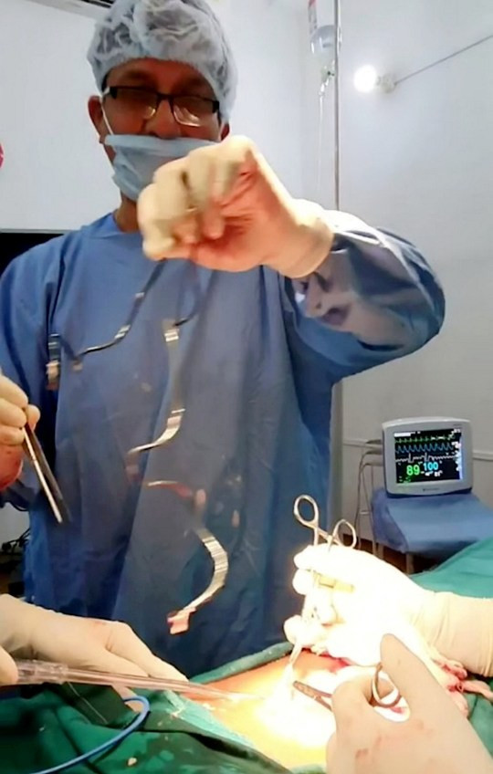Doctor Removed Phone Charger From Man’s Bladder