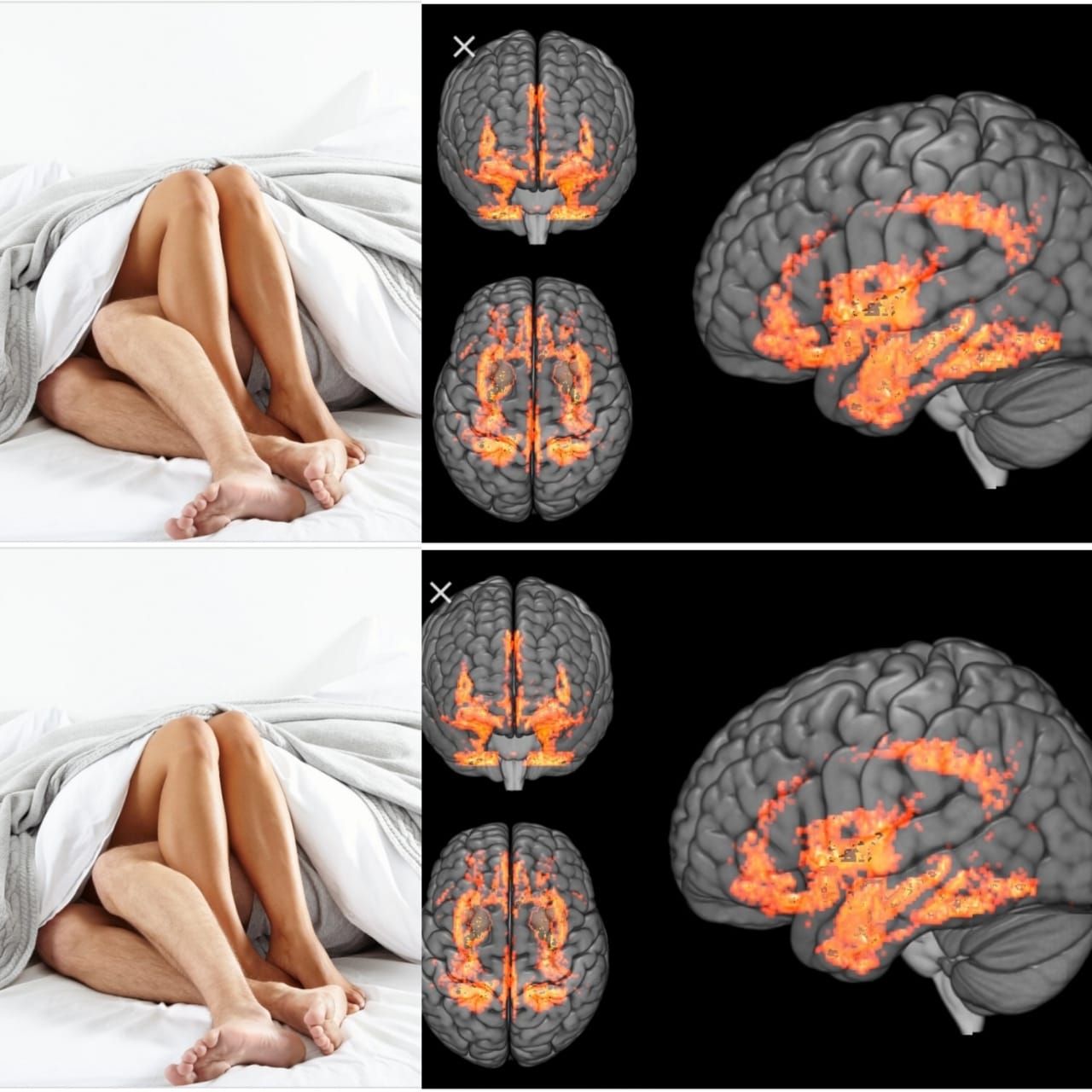 Women Who Have More S ex Have Better Developed Brains